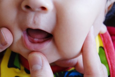 赤ちゃんが舌を出すのは障害 ダウン症なの 原因と対処法を解説 保育士ライフ